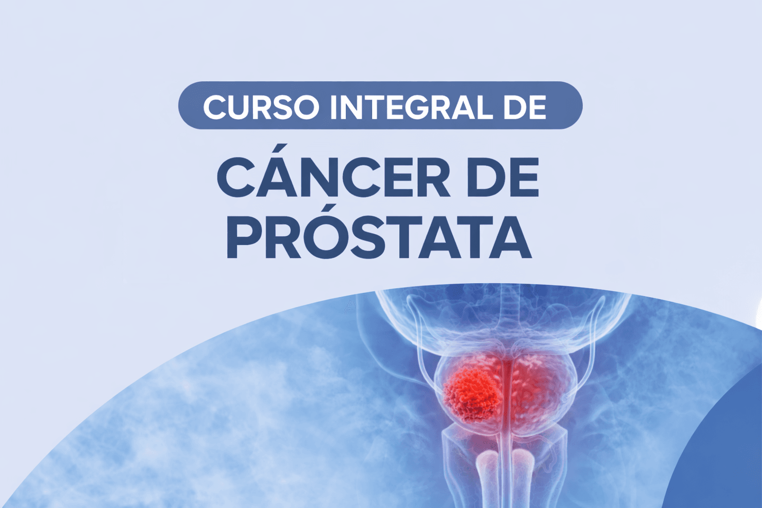 CURSO INTEGRAL DE CÁNCER DE PRÓSTATA